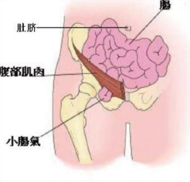 手術後(hòu)抗感染的複合靜電紡絲納米纖維膜疝修補片