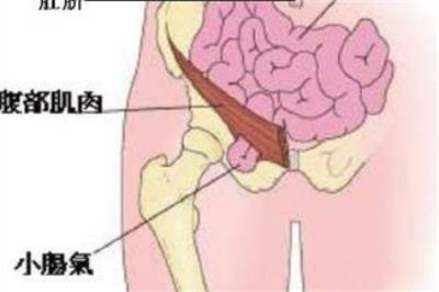 行業資訊-手術後(hòu)抗感染的複合靜電紡絲納米纖維膜疝修補片